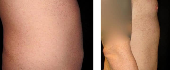 Bukplastik-man-profil