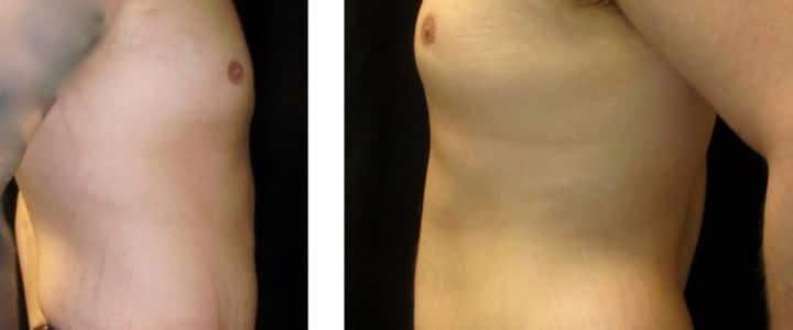 Bukplastik-Man-Profil